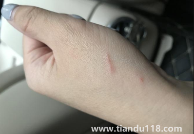 被貓抓了一下輕微破皮要打針嗎(被貓抓傷多少天過危險期)(圖3) 被貓抓了一下輕微破皮要打針嗎3