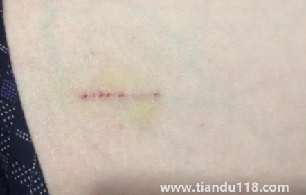 被貓抓了一下輕微破皮要打針嗎(被貓抓傷多少天過危險期)(圖1) 被貓抓了一下輕微破皮要打針嗎1