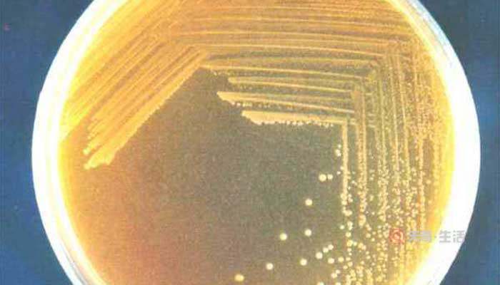 細(xì)菌菌落和真菌菌落的區(qū)別是什么